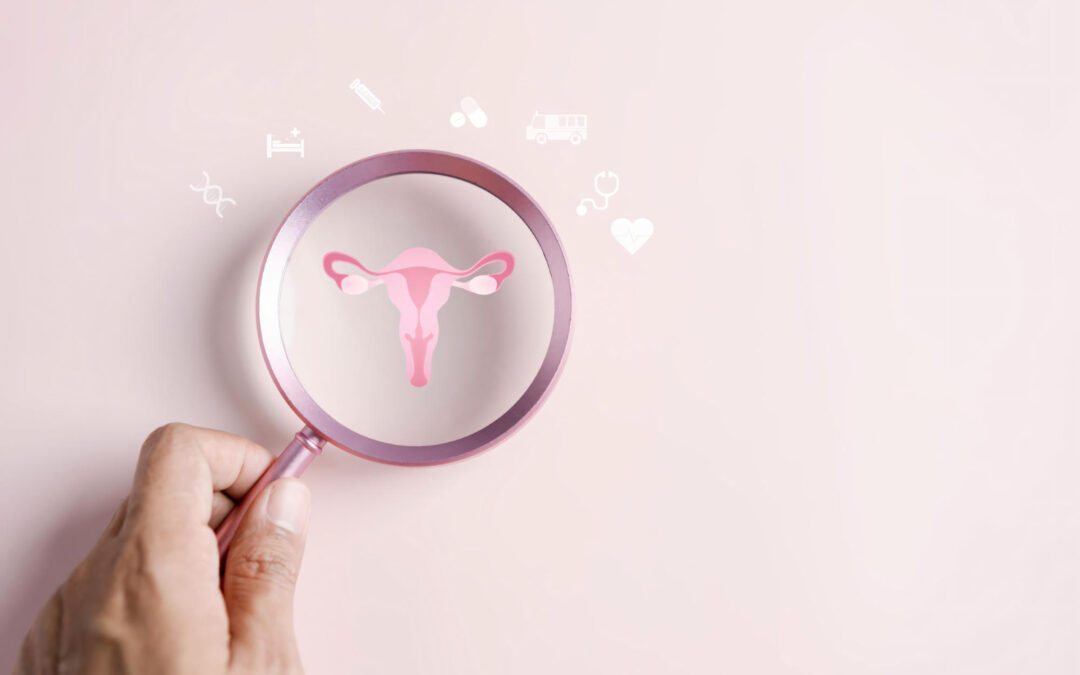 5 Myths About Polycystic Ovary Syndrome (PCOS)